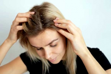 Ayurvedic Remedies At Home to get rid of Dandruff Ayurvedic Remedies At Home to get rid of Dandruff