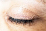 Eyelash Dandruff symptoms, Eyelash Dandruff breaking, all about eyelash dandruff, Eye health