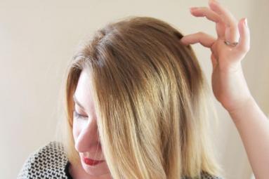 Remedies to get rid of Itchy scalp Remedies to get rid of Itchy scalp