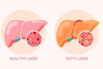 Grade 2 Fatty Liver symptoms, Grade 2 Fatty Liver experts, how to reverse grade 2 fatty liver, Liver health