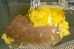 Universal Kidney developed, Universal Kidney new updates, scientists develop universal kidney transplanted to any blood group, Man