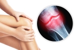 Bone Health Decline breaking, Bone Health Decline problems, signs and symptoms of bone health decline, Malai