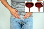 Bladder Cancer treatment, Bladder Cancer health checkup, why is bladder cancer common in men, Cigarette