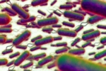 E.coli Outbreak UK, E.coli, all about e coli outbreak in the united kingdom, Sandwich