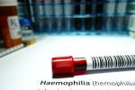 Hemophilia, Hemophilia doctors, why are men likely to develop hemophilia, Therapy